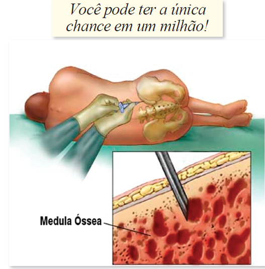Transplante de medula óssea