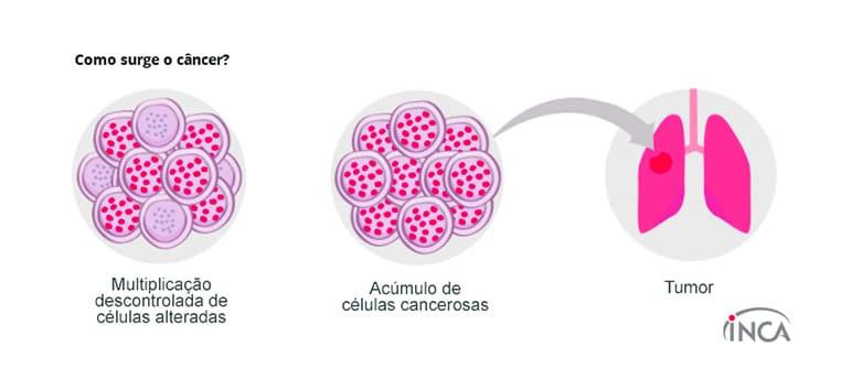 Câncer: o que é, sintomas, diagnóstico, tratamentos e prevenção