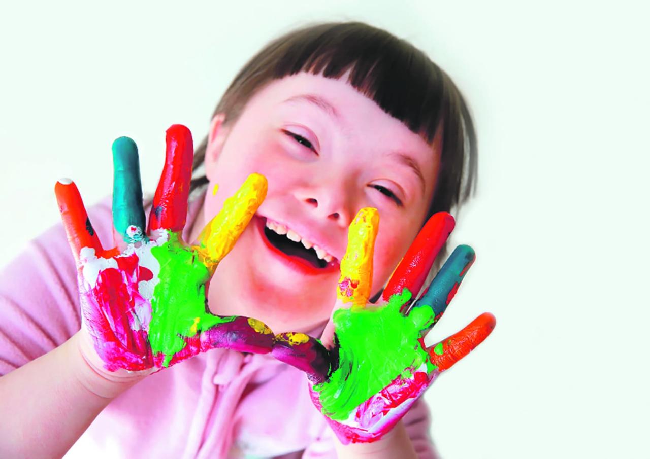 O que é síndrome de Down e quais são as causas?