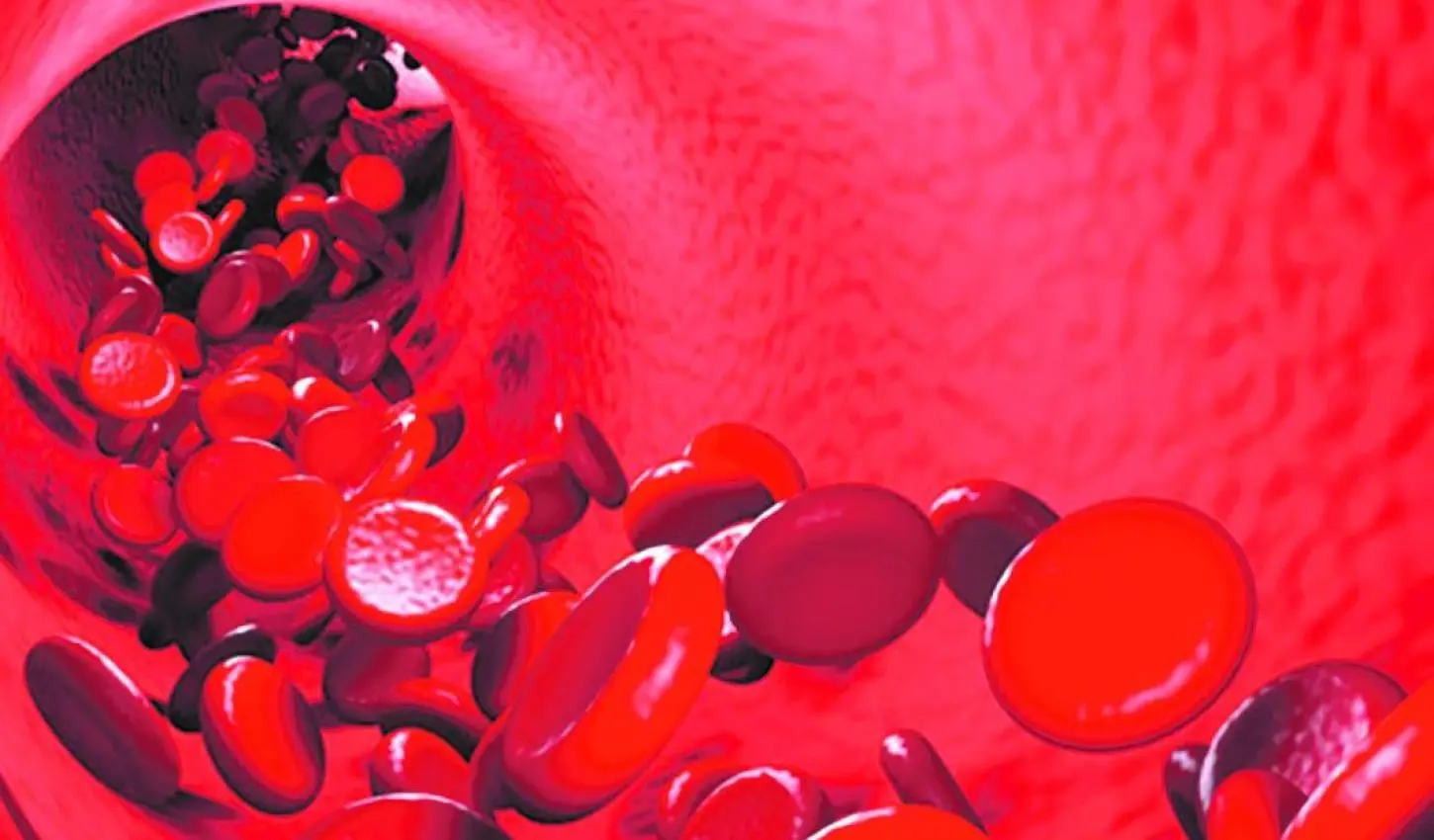 Dia Internacional da Hemofilia – Semanário ZN